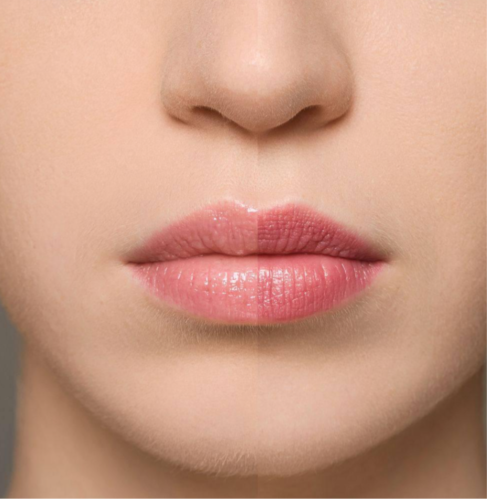 SUPREME LIP TREATMENT – ERDBEERE #MM003
