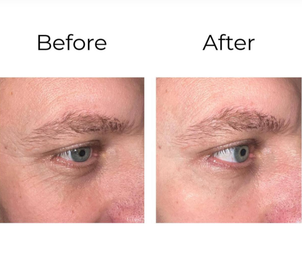 PEPTILUX – ANTI-FALTEN AUGENCREME „SHOCK ACTION"-EFFEKT MIT LIPHASYN™ #LUX001>