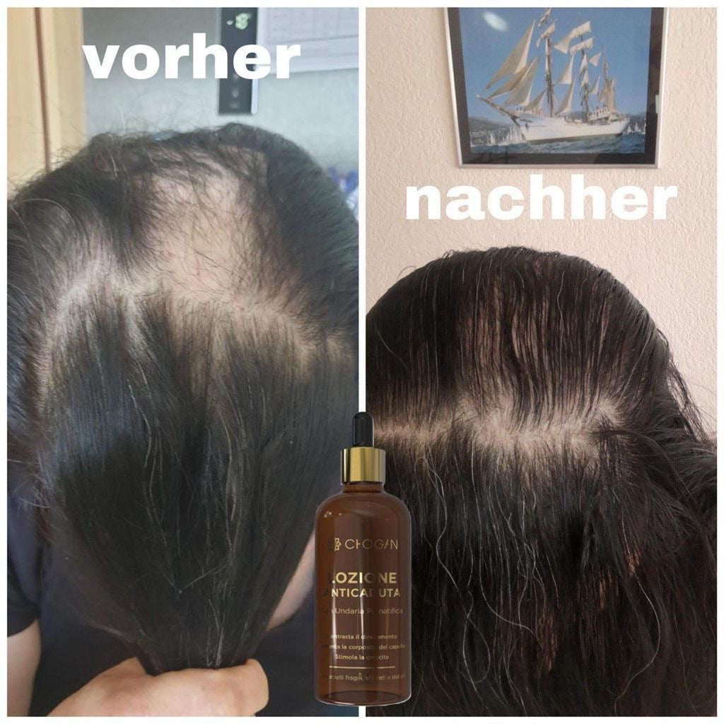 Anti-Haarverlust Lotion mit Undaria Pinnatifida
Angereichert mit Arnika, Leberwurstbaum, Ginseng, Zimt, Salbei, Hafer & Seidenprotein #FA02B