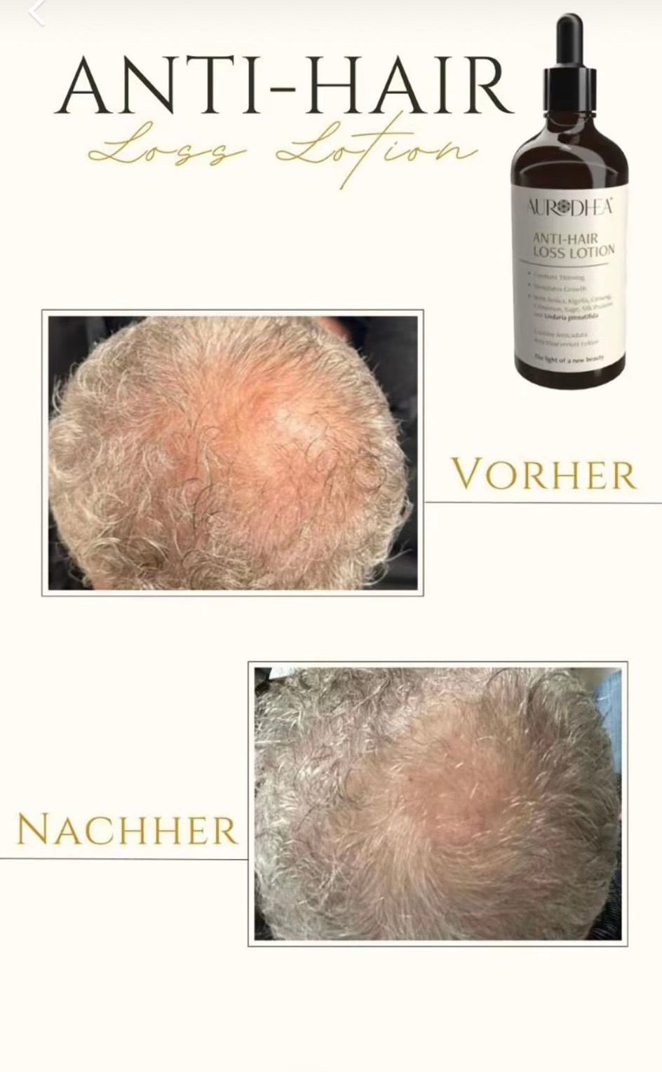 Anti-Haarverlust Lotion mit Undaria Pinnatifida
Angereichert mit Arnika, Leberwurstbaum, Ginseng, Zimt, Salbei, Hafer & Seidenprotein #FA02B