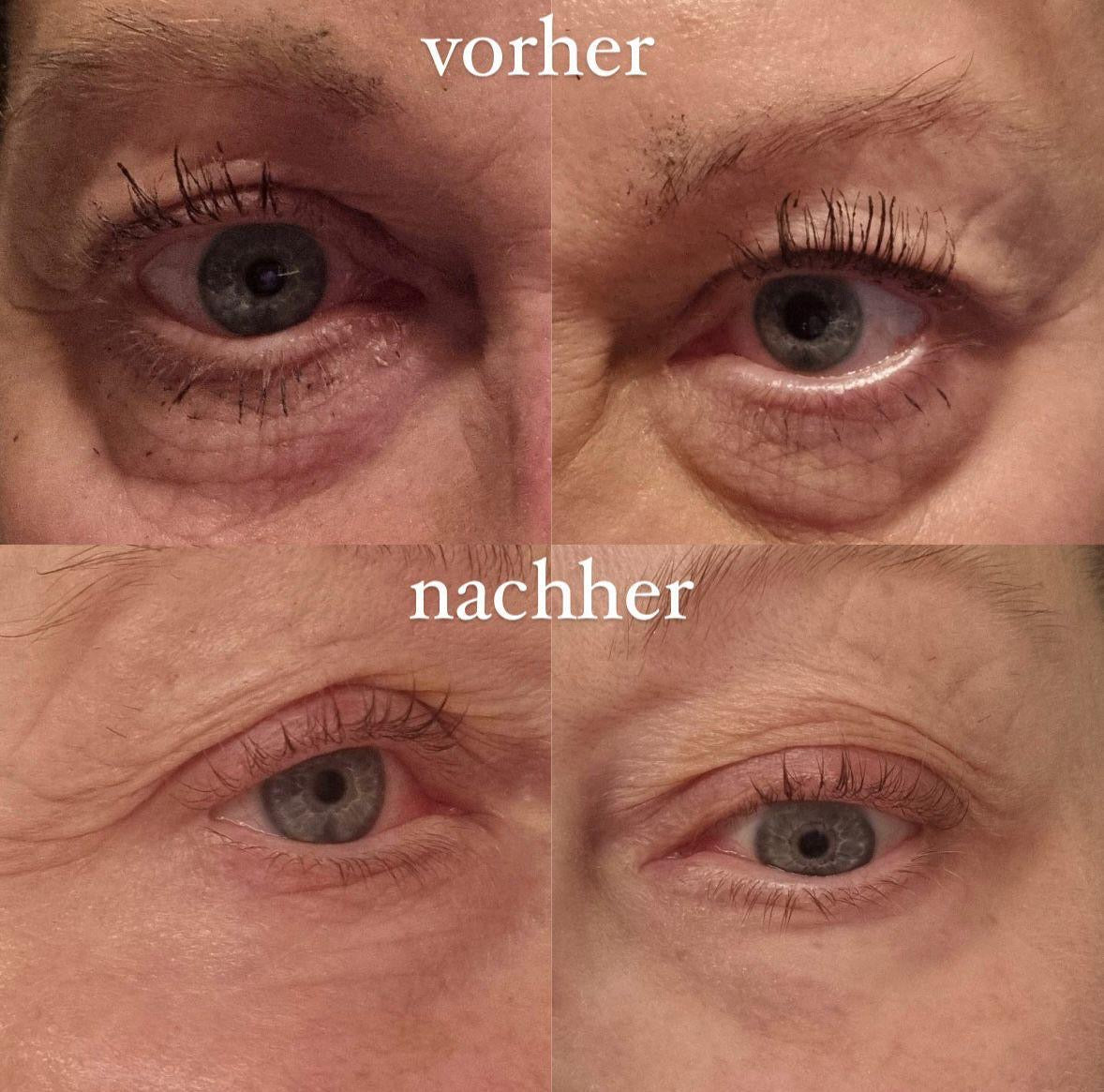 PEPTILUX – ANTI-FALTEN AUGENCREME „SHOCK ACTION&QUOT;-EFFEKT MIT LIPHASYN™  #LUX001